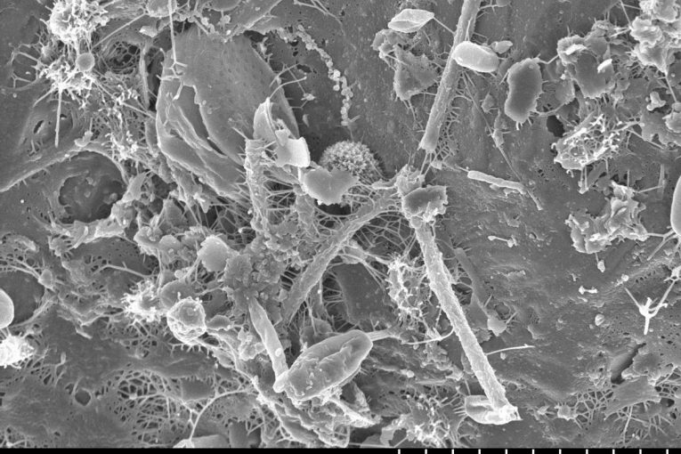 BAM Nuttall and Strathclyde Uni study how bacteria can solidify soil to replace concrete