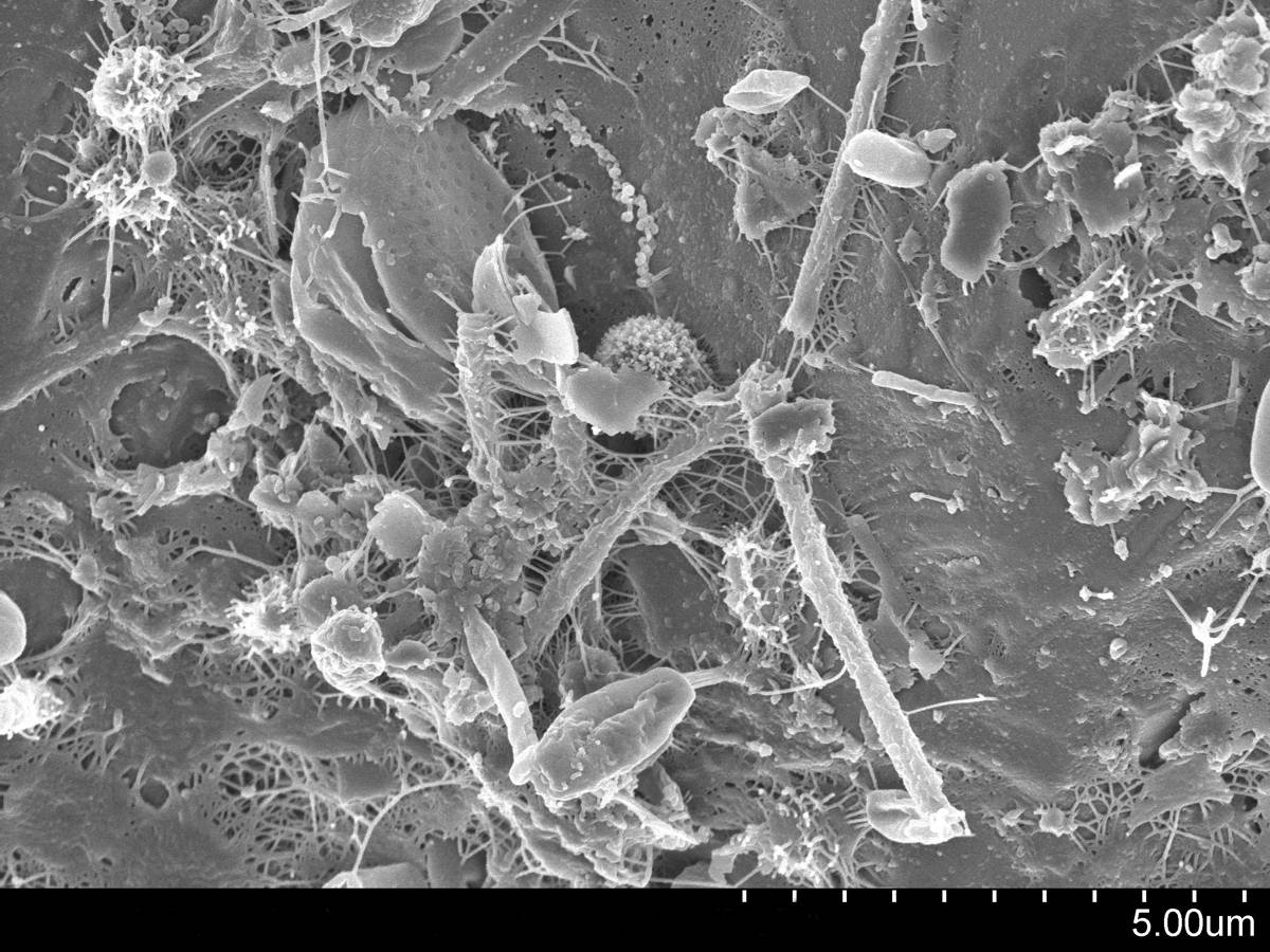 BAM Nuttall and Strathclyde Uni study how bacteria can solidify soil to replace concrete