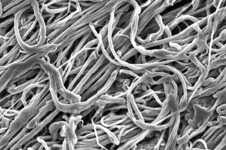 MIT develops ultrafine fibres with exceptional strength