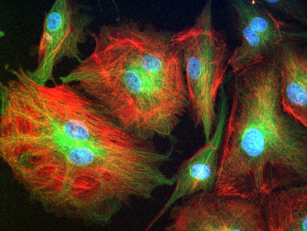 BPAE Cells - Photo by Joseph Elsbernd