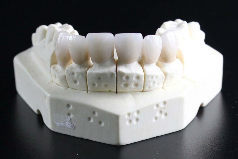 Idaho National Laboratory explores how teeth can teach us about modern materials